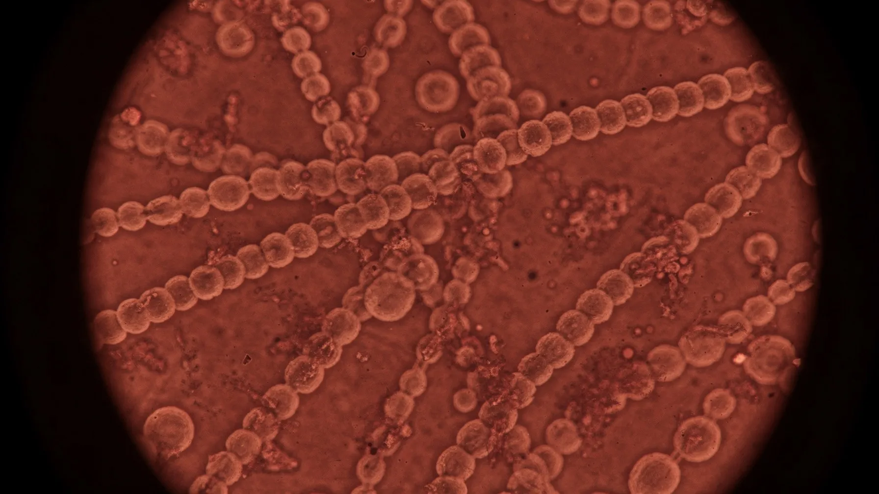 Light microscope view of chains of small round bacteria strung together like beads, backlit in red.